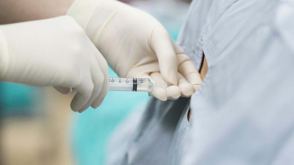 epidural injections